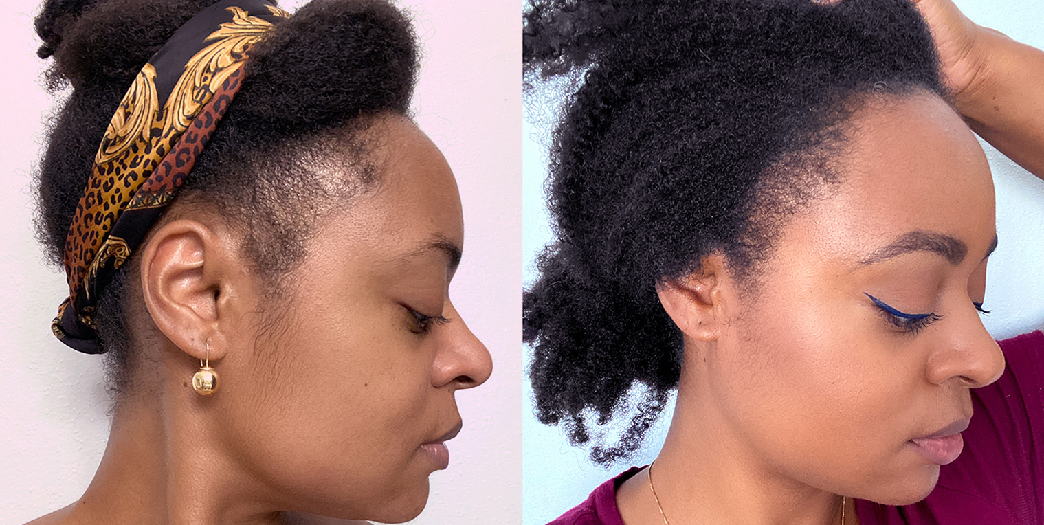 Best Product To Regrow Thin Damaged Edges | Type 4 Hair - LaToya Ebony